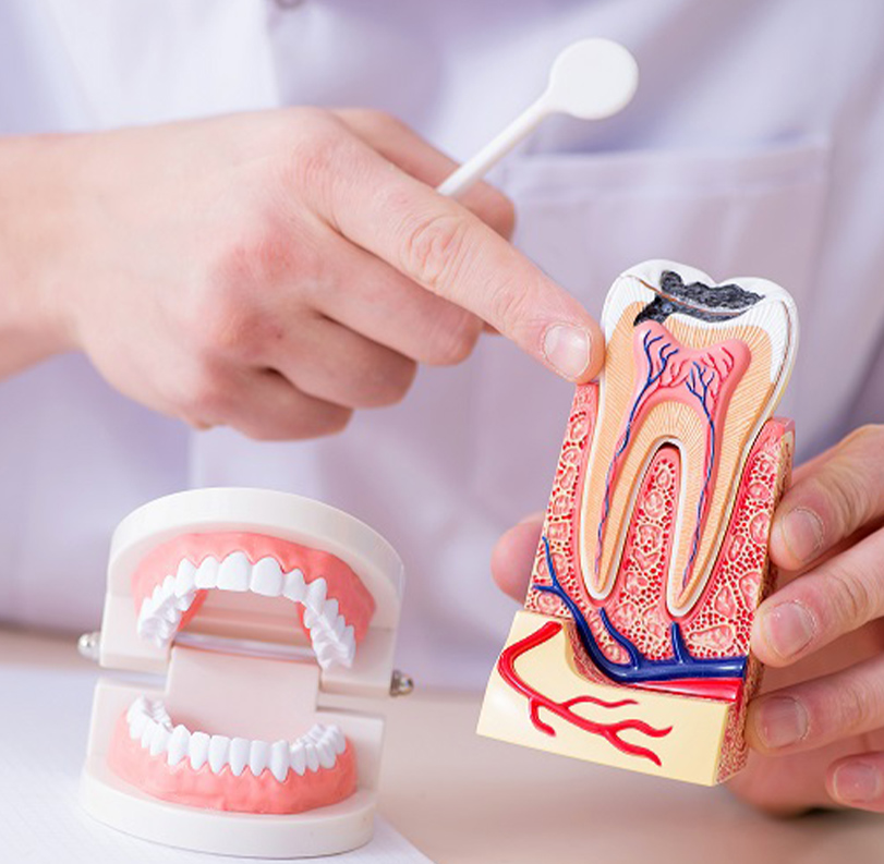 cataneo_endodonzia2